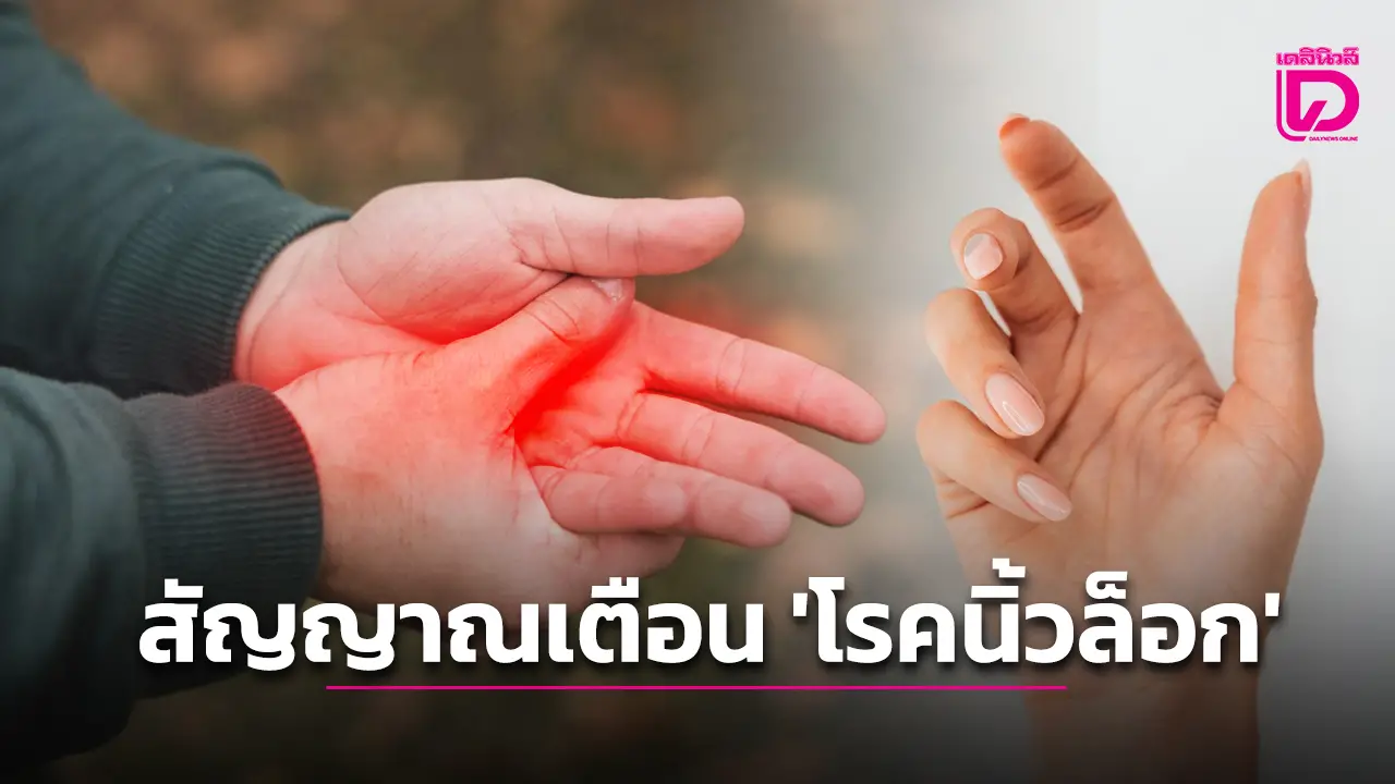 ใครมีอาการแบบนี้บ้าง!… ตึงนิ้ว ขยับแล้วติด สัญญาณเตือน ‘โรคนิ้วล็อก’