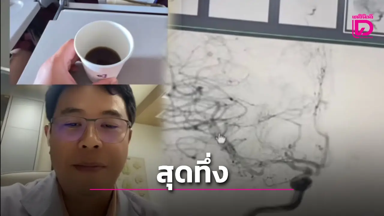 ‘หมอประชา’ เผยเคสหญิงดื่มกาแฟแล้วใจสั่น จนสมองขาดเลือดเฉียบพลัน