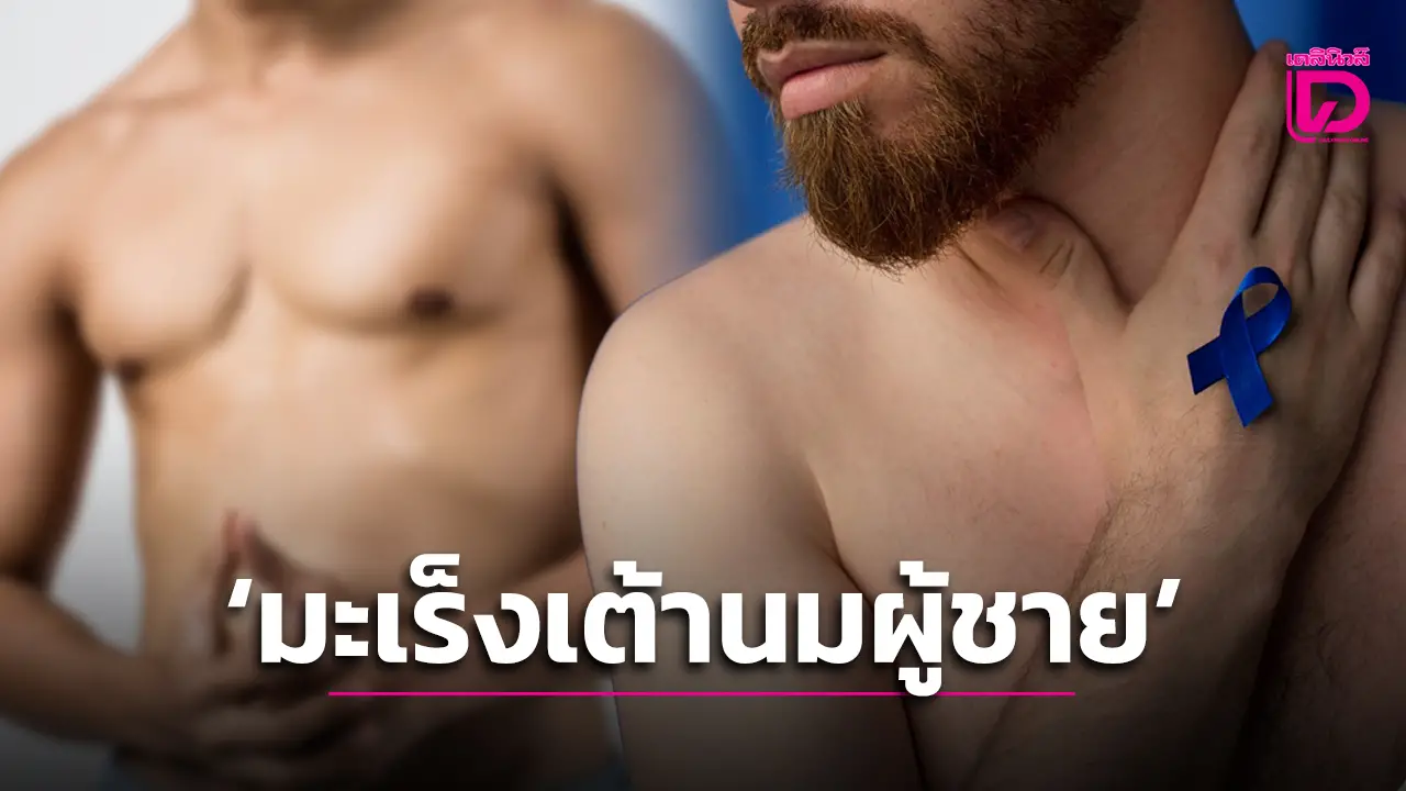 ‘ผู้ชาย’…ก็เป็น‘มะเร็งเต้านม’ได้…มีวิธีสังเกตอย่างไร เช็คเหมือนกับเต้านมผู้หญิงหรือไม่