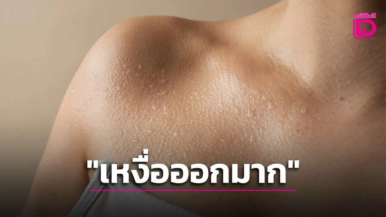 หมอเตือน ! เหงื่อออกมากผิดปกติ อาจส่งสัญญาณโรคร้าย