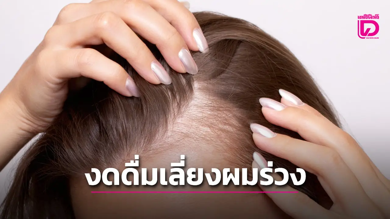 ผลการศึกษาชี้ เครื่องดื่ม 2 ชนิดที่ควรเลี่ยงหากไม่อยากผมร่วง-ผมหงอก