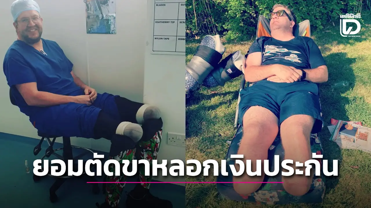 ศัลยแพทย์ยอมแช่แข็งขาตัวเองจนเน่า เพื่อตัดขาเอาเงินประกันกว่า 20 ล้าน