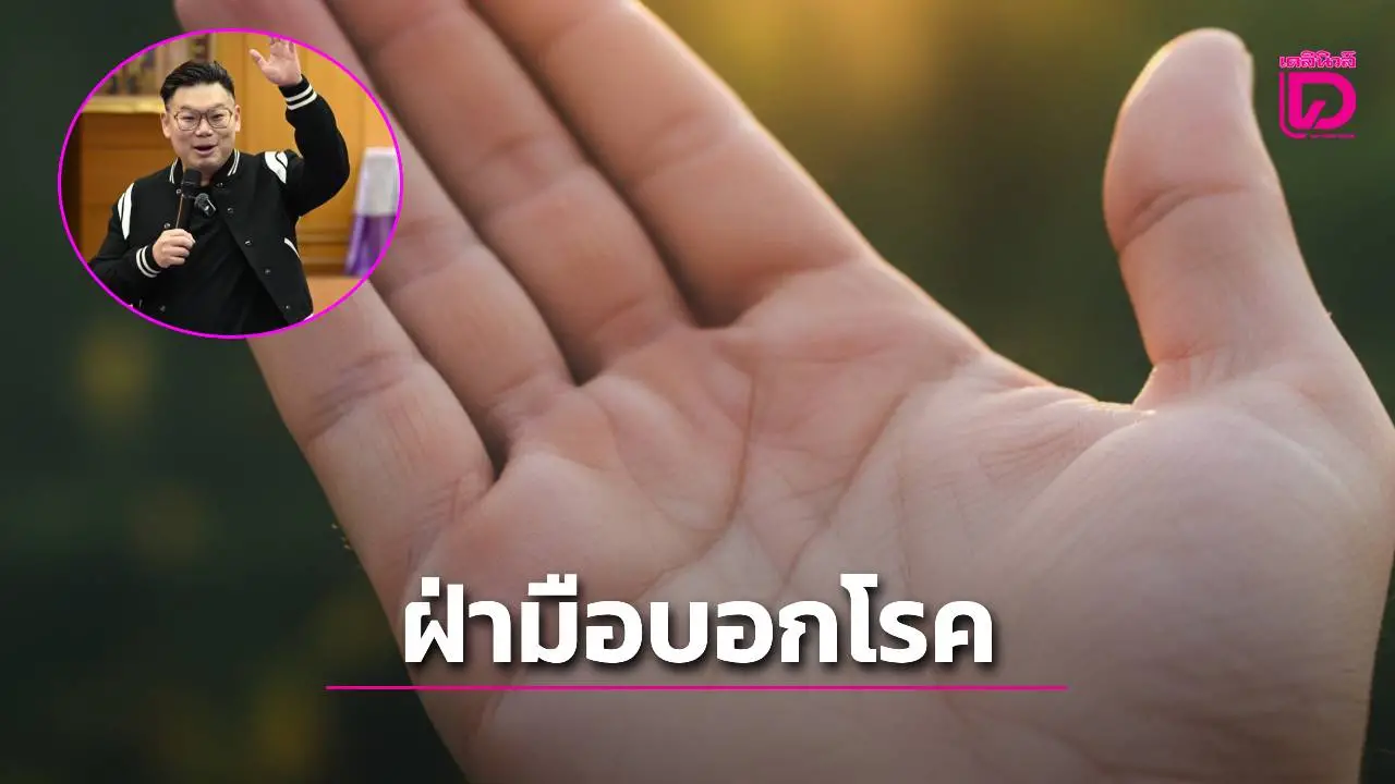 ฝ่ามือบอกโรค เช็กเลย ! เจอแบบนี้เสี่ยงโรคอะไร เพราะบางสัญญณอันตรายกว่าที่คิด