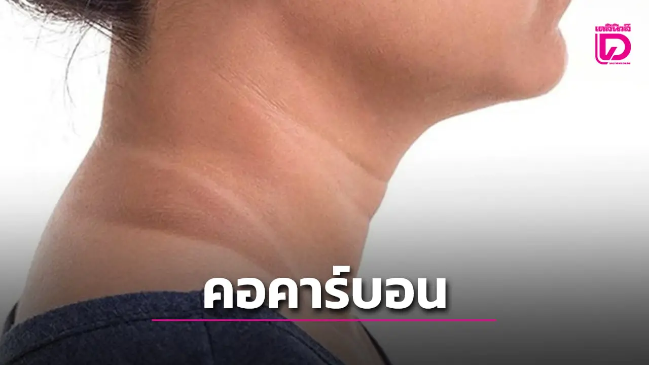 เช็กด่วน! ‘คอคาร์บอน’ สัญญาณบอกโรคร้าย