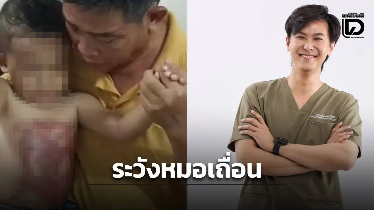 เด็กถูกน้ำร้อนราดหน้าอกอ้างรักษาอาการช็อก เสี่ยงไตวาย – หมอเตือนระวังหมอเถื่อน