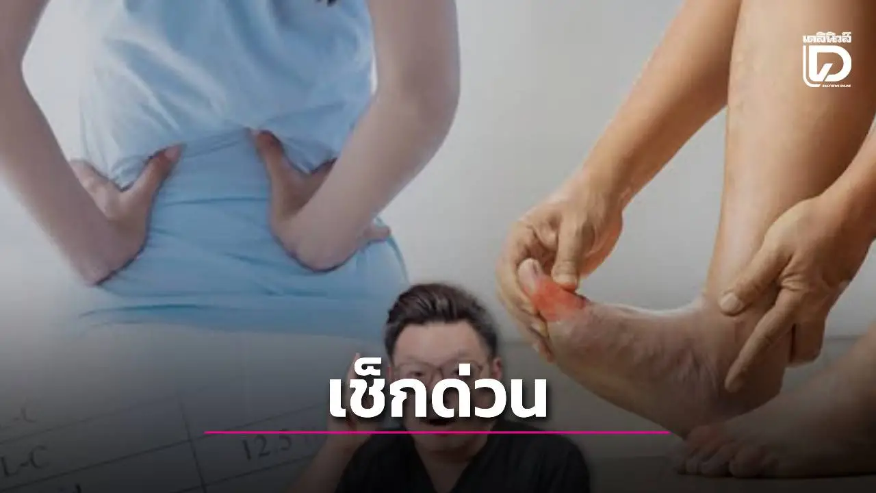 หยุดทำสิ่งนี้ทันที! 'หมอเจด' เตือน! ถ้า 'ยูริก' ทะลุเกิน 7! เสี่ยง 'เกาต์เฉียบพลัน' ไตพังไม่รู้ตัว!