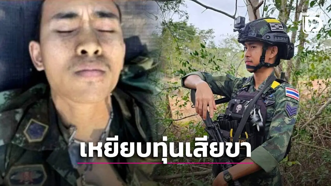 สันติภาพไม่มีจริง! ทหารไทยต้องเสียขารายที่ 9 เหยียบทุ่นระเบิด เพื่อนอีกนายเจ็บจากแรงอัด