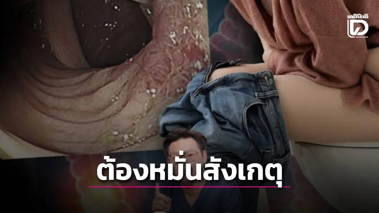 อย่าชะล่าใจ! ถ่ายปกติไม่ได้แปลว่ารอด 'มะเร็งลำไส้' เผยจุดสังเกตที่คนมักมองข้าม