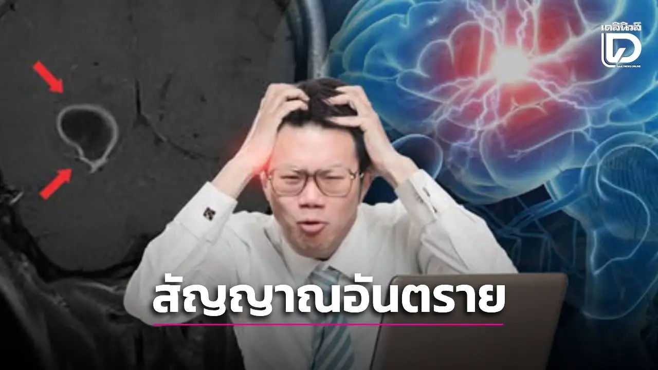 'หมอเจด' เปิด 4 จุดเช็กปวดหัวข้างเดียว! เตือนสัญญาณ 'คอแข็ง-อ่อนแรง' เสี่ยงโรคร้ายถึงตาย